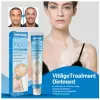South Moon Vitiligo Treatment Cream thumbnail