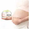 Youngcome Stretch Mark Removal Cream thumbnail